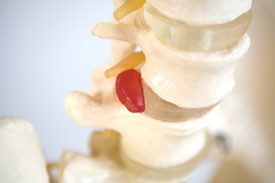 chiropractic spine model