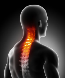 loss of lumbar lordosis due to muscle spasm