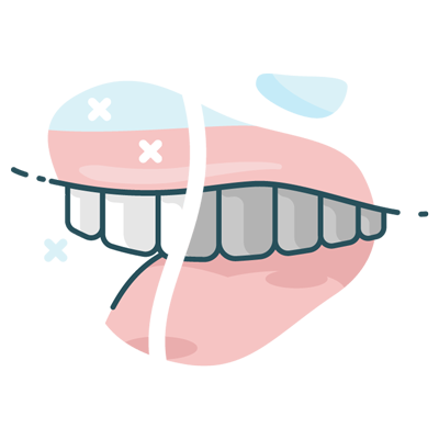 Teeth whitening illustration