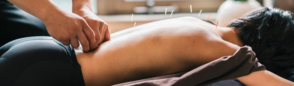 Dry needling applied to patient's back