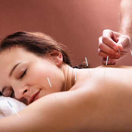 Needles in womans shoulder