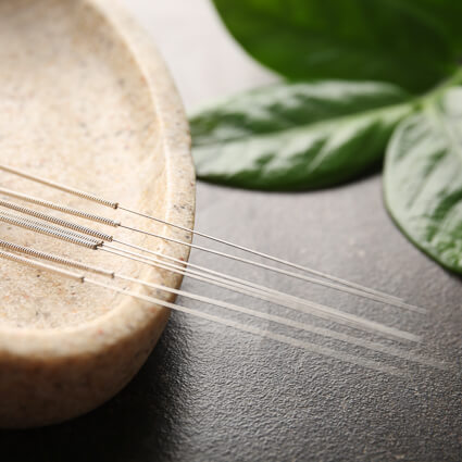 Dry needling needles