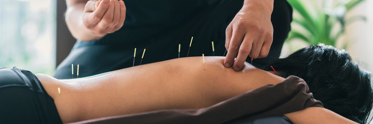 Patient treated with dry needling