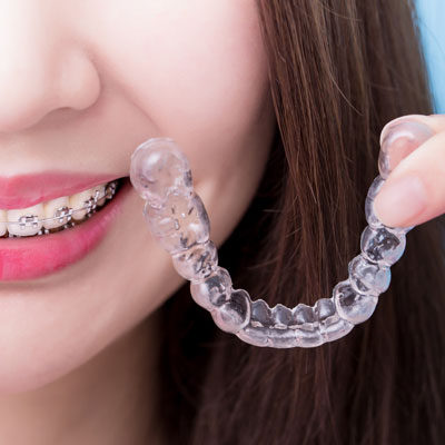 Young woman wearing traditional braces and holding an invisible one