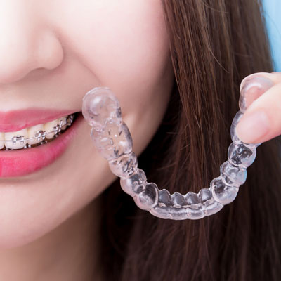 Woman wearing braces holding aligner