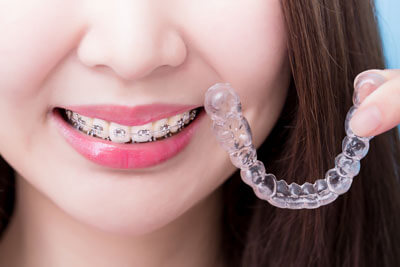 traditional braces on teeth, clear aligner in hand