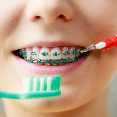 Traditional braces with toothbrush