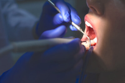 Looking inside patient's mouth