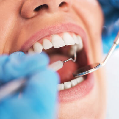 looking inside patient's mouth