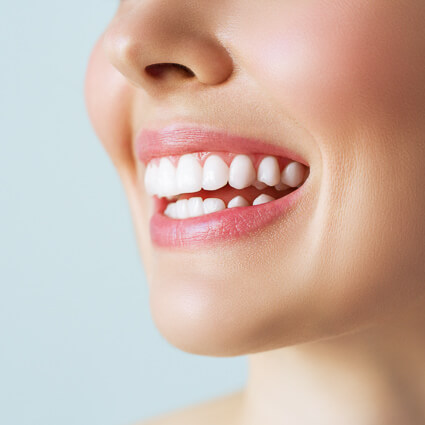 woman smiling with beautiful teeth