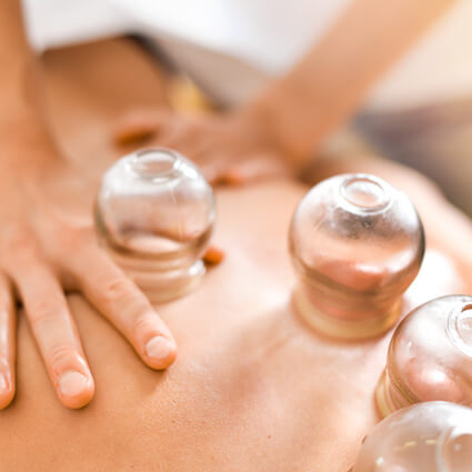 cupping therapy on persons back