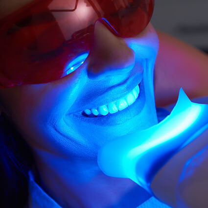 Teeth whitening light