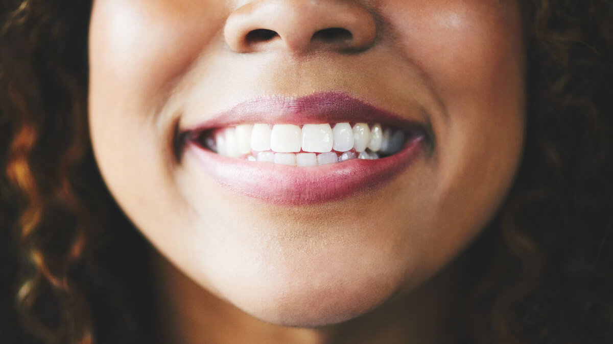 Beautiful close up of white teeth