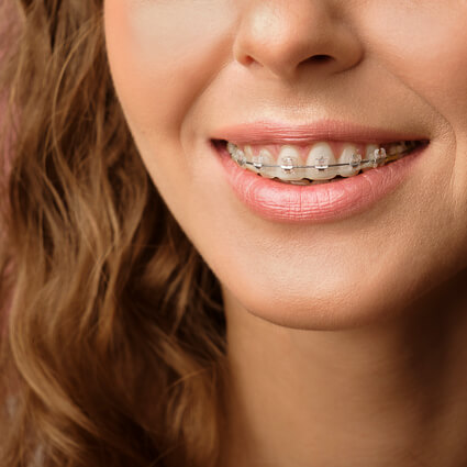Young woman wearing braces