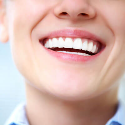 person with white teeth smiling