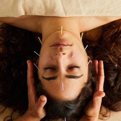 Woman with acupuncture needles on face