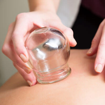 Person receiving cupping therapy