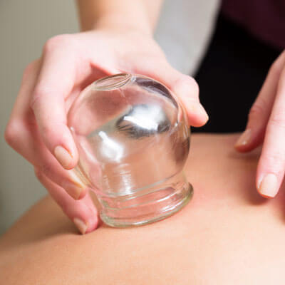 cupping therapy on person's back