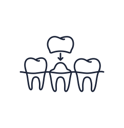 Illustration of dental crown