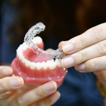 custom mouthguard on a tooth model