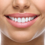 Teeth Whitening Promotion