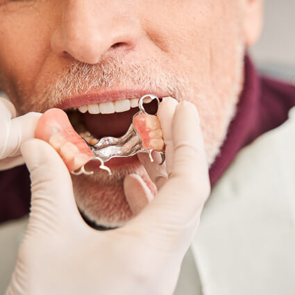 Dentist fitting dentures