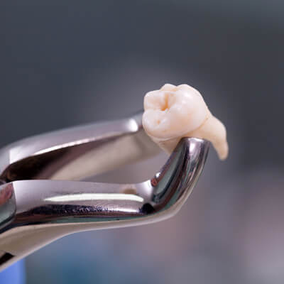 Holding extracted tooth