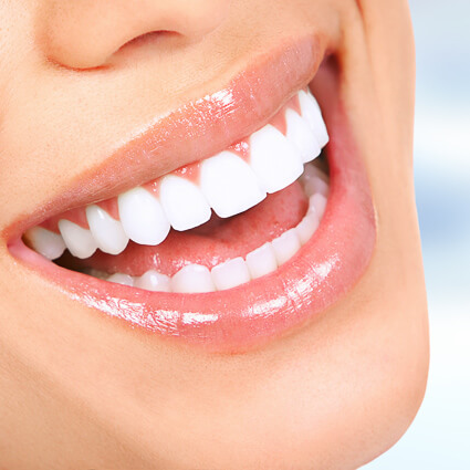 extremely white teeth