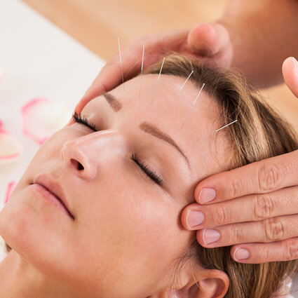 Facial massage with acupuncture needles in forehead