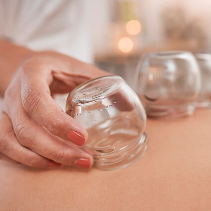practitioner putting cups on patients back