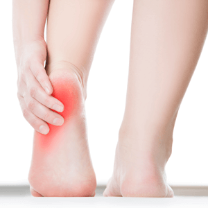 Woman with heel pain