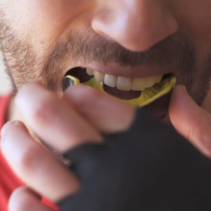 Mouthguard
