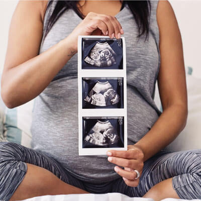 Pregnant woman holding sonograms