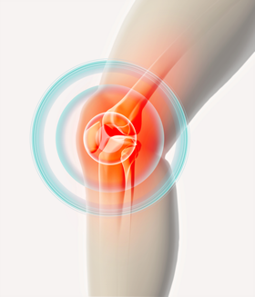 Illustration of knee joint inflamed