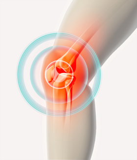 Radiating knee pain