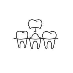 Illustration of dental crown