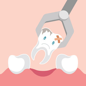 Illustration of dental extraction