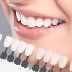 woman with teeth whitening chart next to her teeth