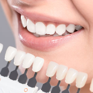 whitening chart next to teeth