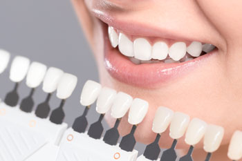 teeth whitening charts