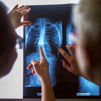 2 people pointing at a spine xray