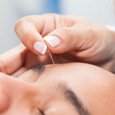 Inserting needle in forehead