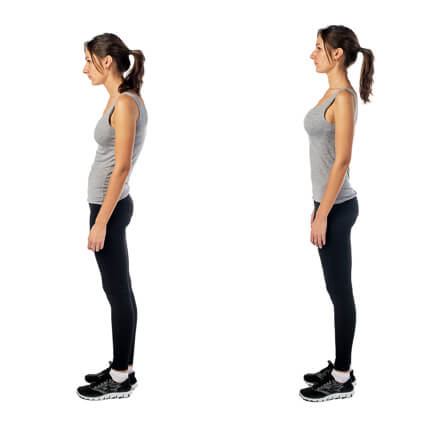 woman swayback posture vs straight back