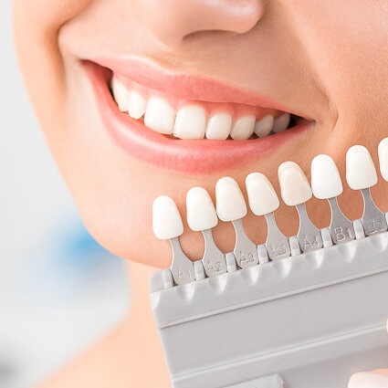 teeth whitening comparison against womans teeth