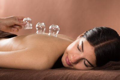 Cupping Therapy Patient