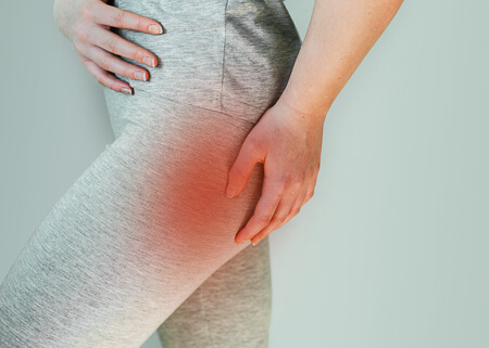 Sciatica pain overlay on woman